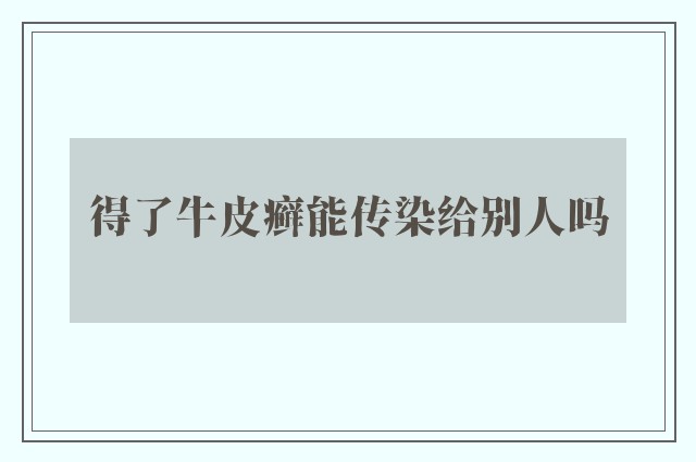 得了牛皮癣能传染给别人吗