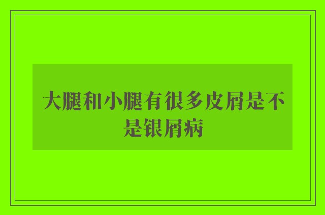 大腿和小腿有很多皮屑是不是银屑病